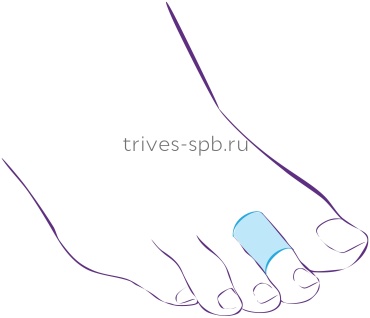 Trives кольцо на палец СТ-45М белый 2 шт