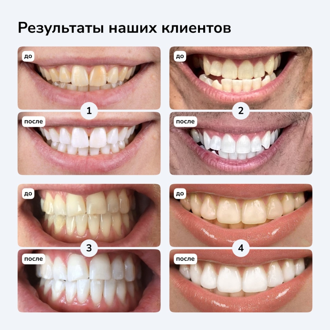 Фото 3