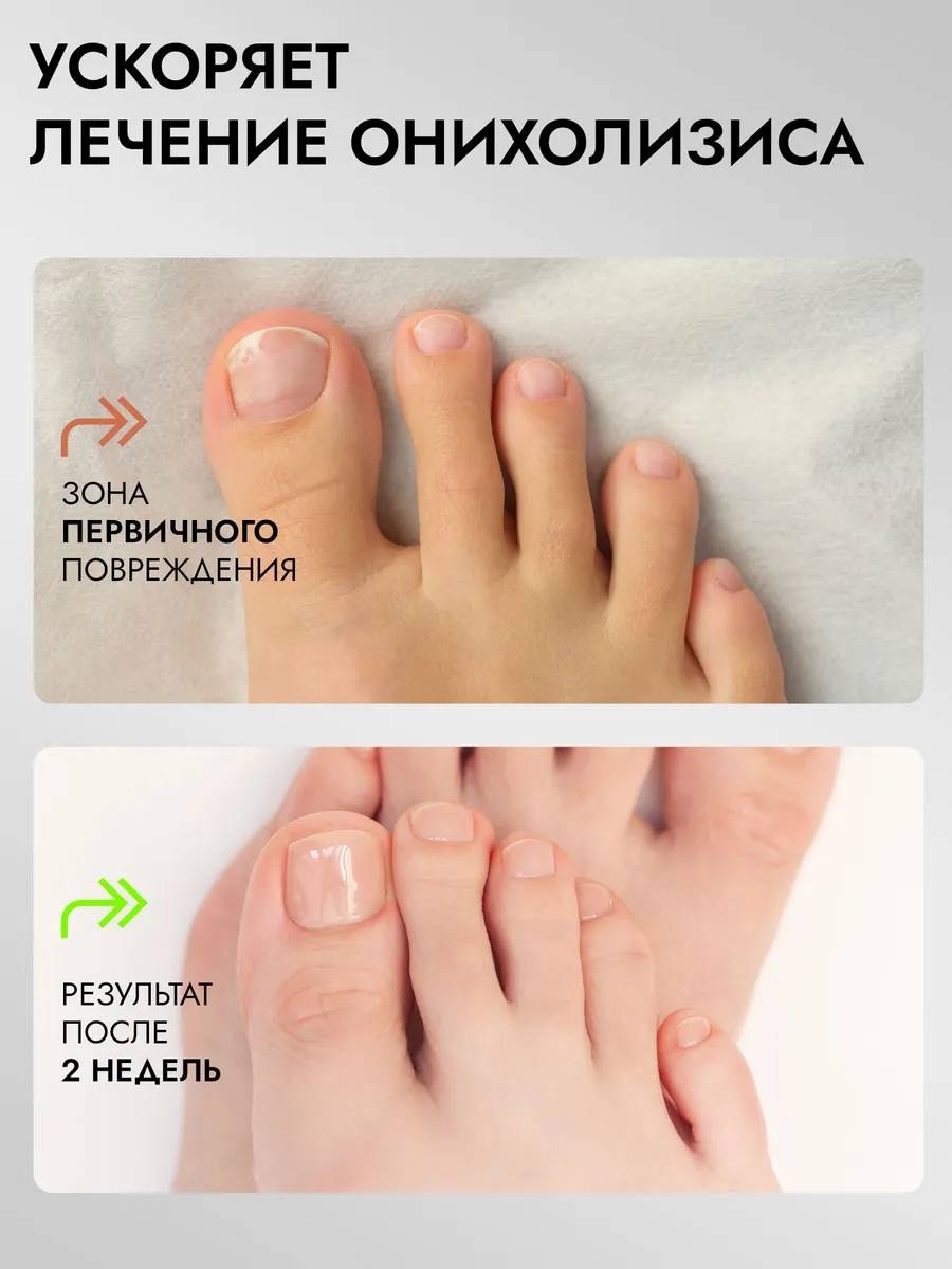 Фото 5