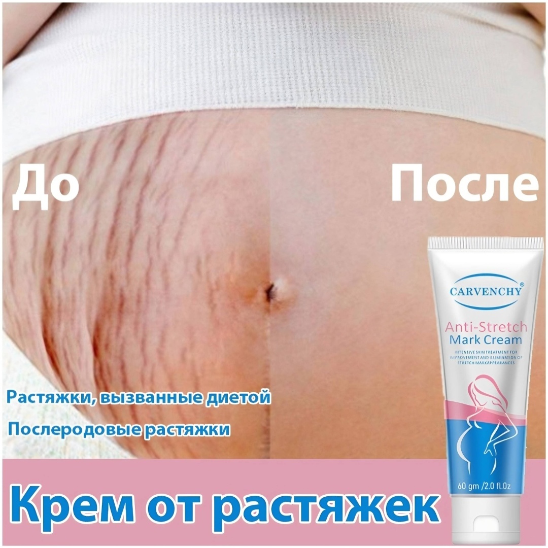 Carvenchy Крем от растяжек крем-гель для тела 60 мл