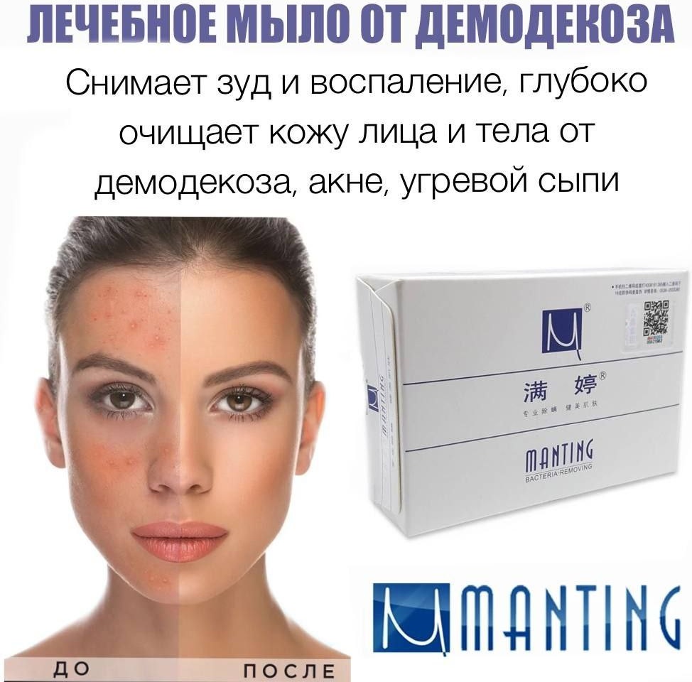 Кусковое мыло туалетное MANTING 065598177 1 шт
