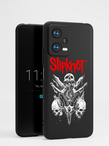 Чехол для Xiaomi X5 рисунок
