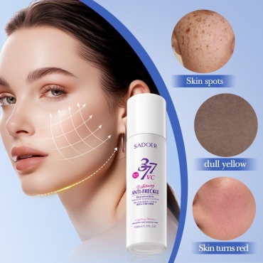 SADOER молочко Whitening and Freckle-Removing Essence Milk - Отбеливающее и удаляющее веснушки для лица 100 мл