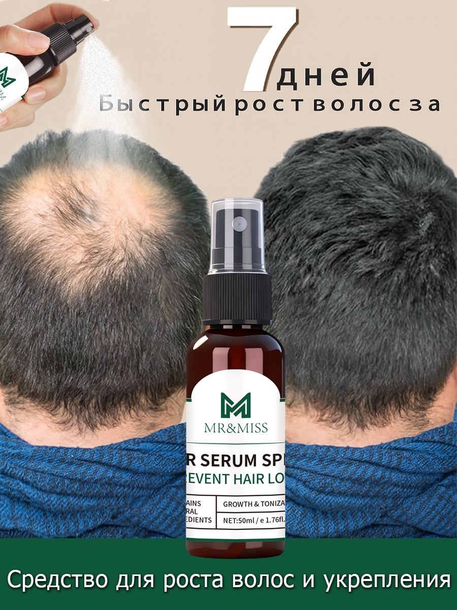 Средство для роста волос и укрепления, спрей для предотвращения выпадения и стимуляции роста новых, для мужчин и женщин спрей-концентрат 50 мл