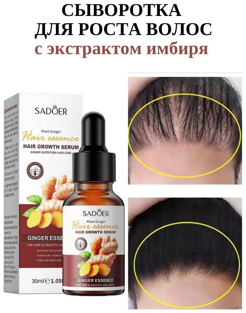 SADOER Ginger Hair Growth Serum Сыворотка для роста волос с имбирем сыворотка 30 мл