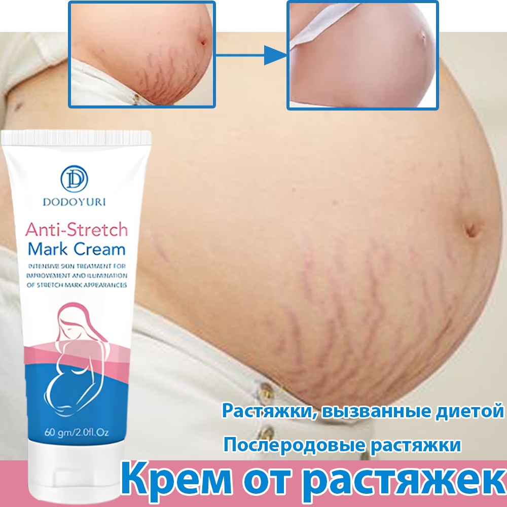 Dodoyuri Крем от Растяжек — Укрепление, Питание и Повышение Эластичности Кожи крем 60 г