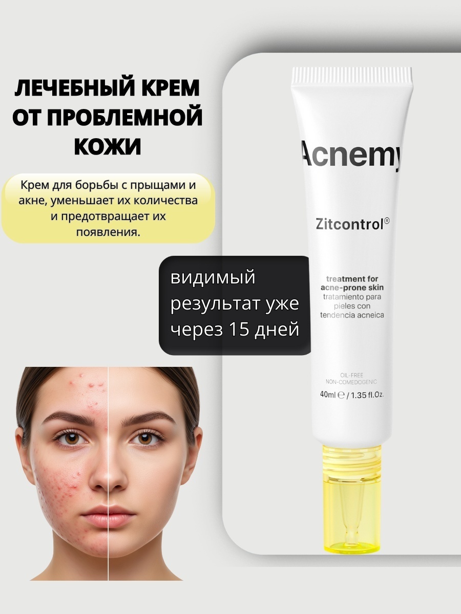 Acnemy крем Zitcontrol Treatment For Acne-Prone Skin для лица 40 мл