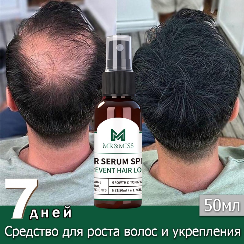 Cредство для роста волос и укрепления,универсальный спрей для роста волос для мужчин и женщин спрей-концентрат 50 мл