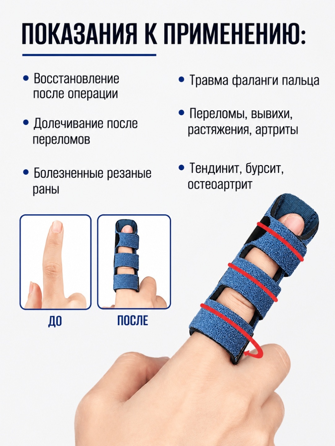 Ортез на палец — фото 2