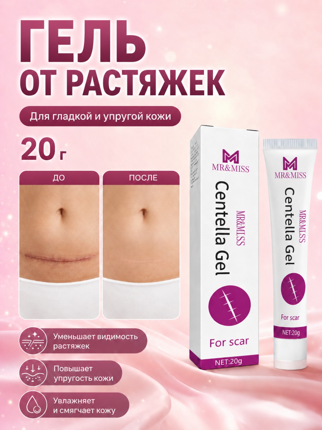 MR&MISS Гель от растяжек MR&MISS 20 г для тела гель 20 г