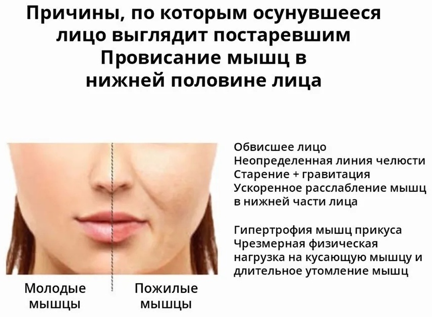 Маска для лица Facelift миостимулятор — фото 8