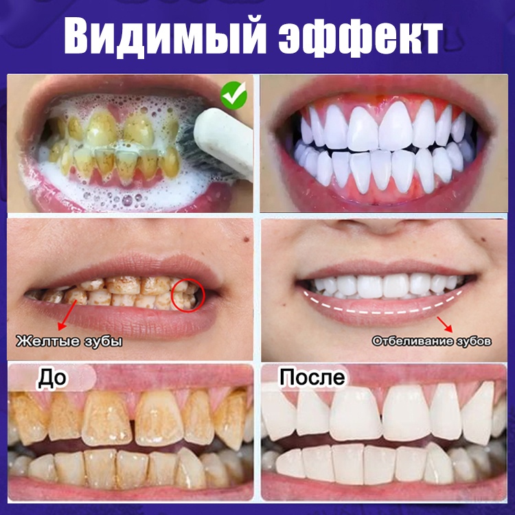 Фото 4