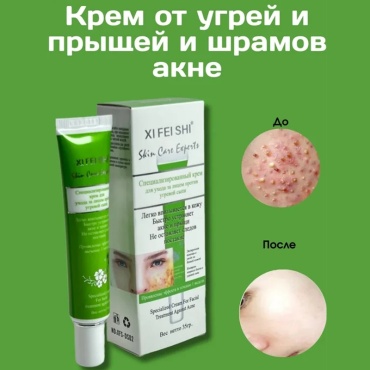 Xi Fei Shi От прыщей и акне Skin Care Experts крем 1 шт