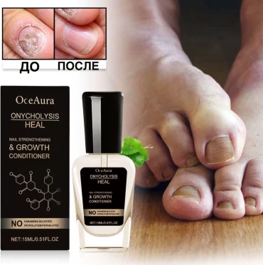 OceAura масло анти онихолизис 15 мл
