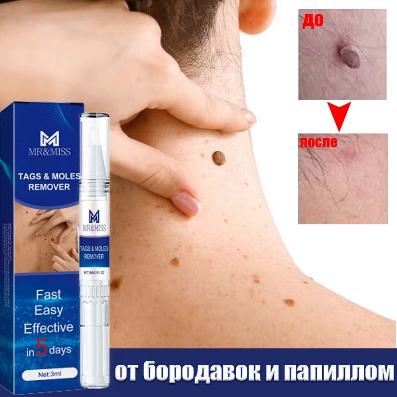 MR&MISS Карандаш от папиллом 3 мл – Удаление папиллом безопасно жидкость 1 шт