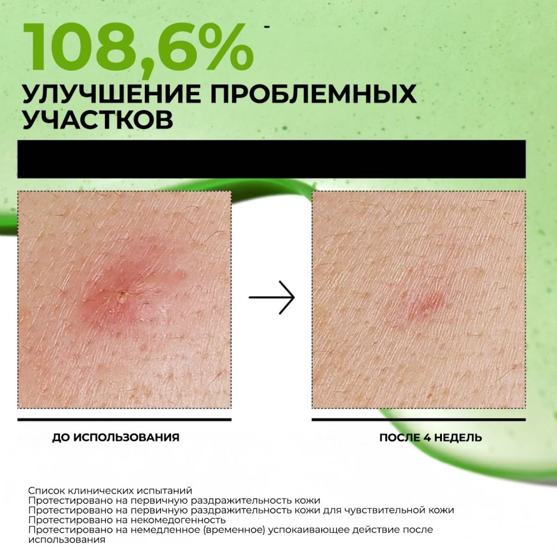 Anua сыворотка Azelaic Acid 10 Hyaluron для лица 30 мл, фото 4