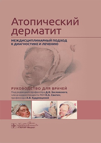 Под ред. Заславского Д.В., Свитич О.А., Кудрявцевой А.В.: Атопический дерматит. Междисциплинарный подход к диагностике и лечению: руководство для врачей