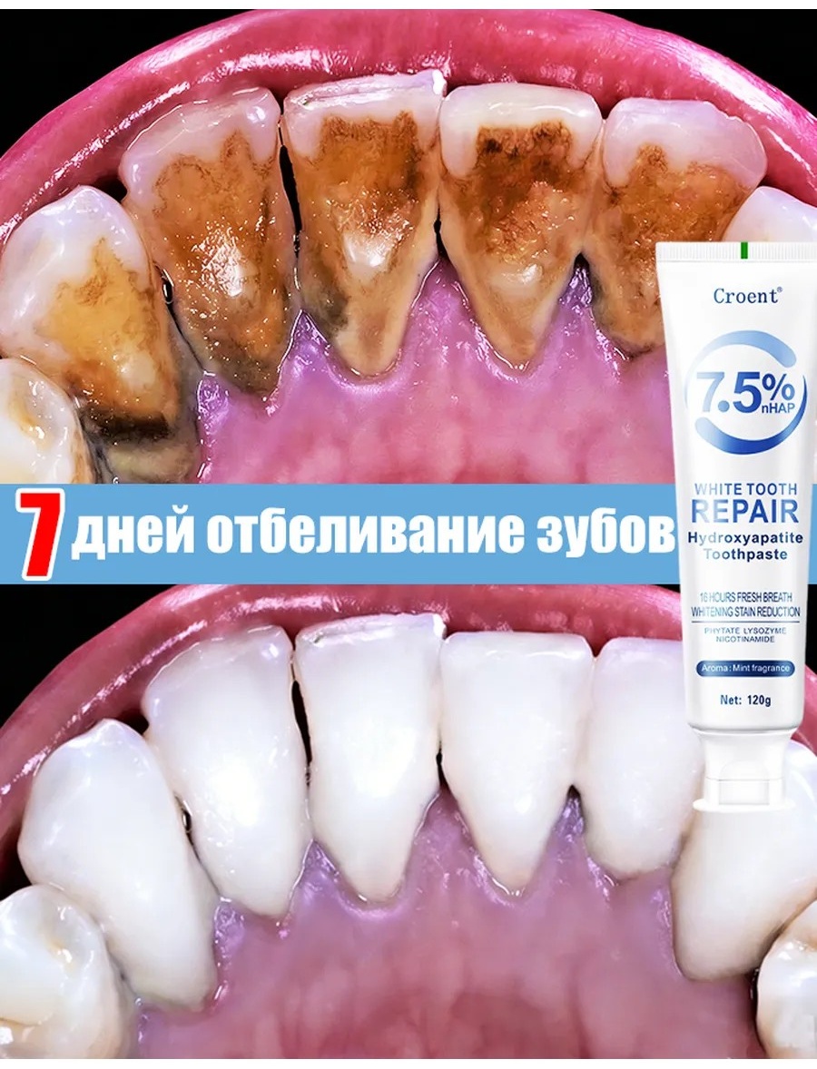 Зубная паста профессиональная отбеливающая зубная паста 120 г