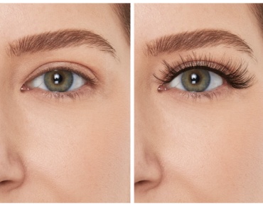 Фото 2