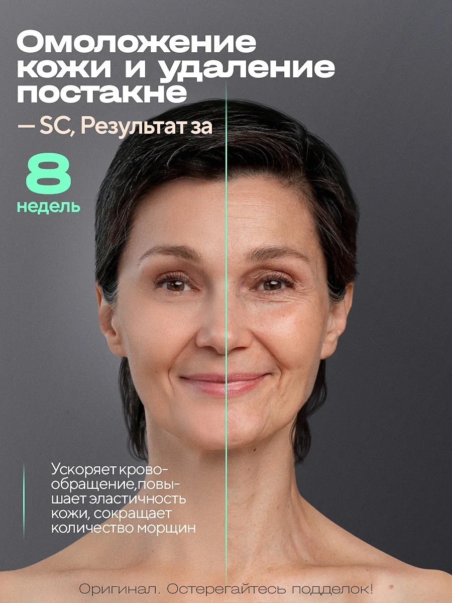 Фотоэпилятор White IPL Premium — фото 6