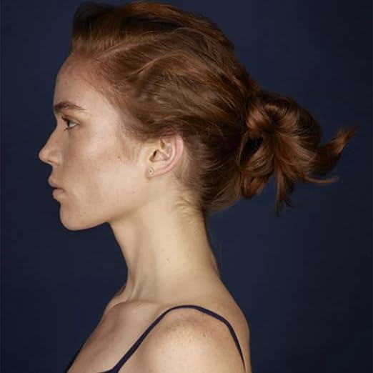 Фото 3